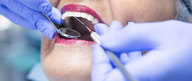 Best Emergency Treatment for Dental Infections or Abscesses in Schofield, WI